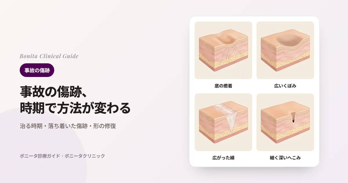 同じ皮膚の断面ブロック4つに、底が線維に引き留められてへこんだ傷跡、脂肪層が減って広くへこんだ所、広がった傷跡の線、細く深いへこみをそれぞれ描き、主に検討する方法を書いたカード