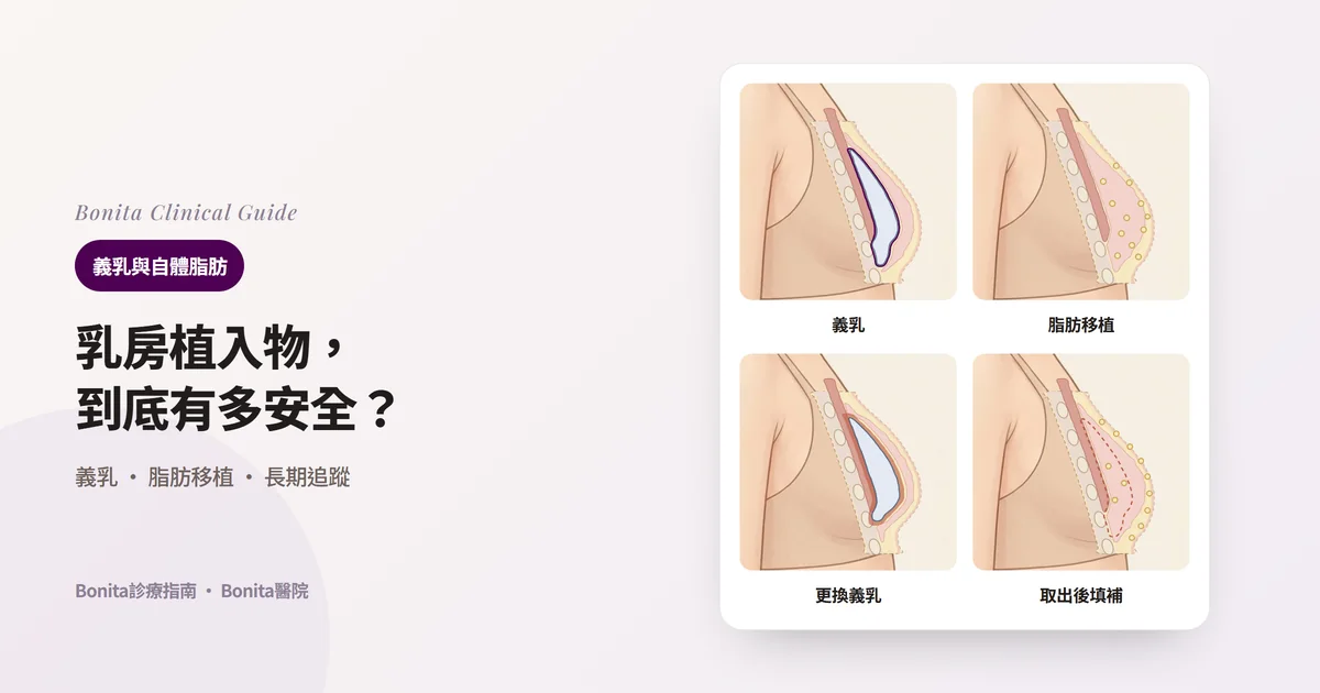 四張乳房側面剖面圖：乳腺下的義乳與莢膜、分小份注入乳房組織之間的脂肪、被增厚莢膜擠壓的義乳、取出義乳後的空間與注入皮下的脂肪，並寫出各自適合的情況與需要了解的重點