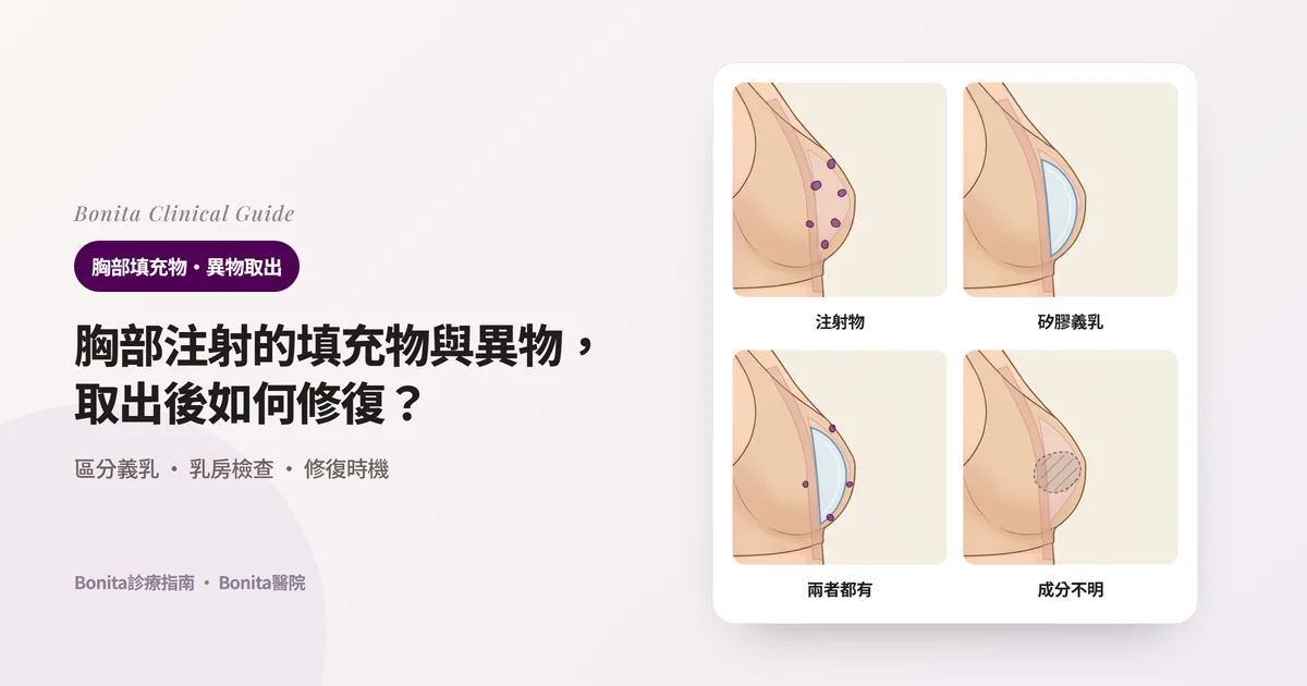在同一張乳房側面圖上疊畫內部情況的四張卡片：只有注射物、只有矽膠義乳、兩者都有、不清楚是什麼，並寫出各自的處理方向