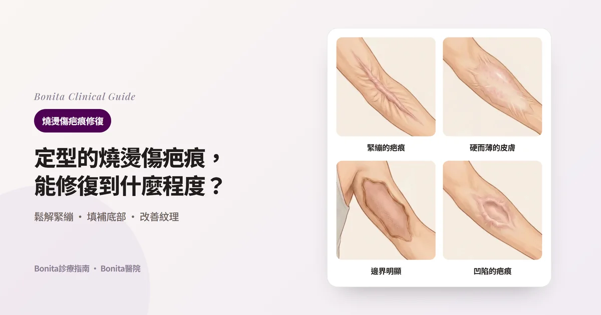 在手臂插畫上分別畫出橫過肘窩緊繃的厚疤痕帶、前臂變硬變薄的疤痕皮膚、上臂邊界明顯的大面積疤痕、前臂凹陷的疤痕，並寫出Bonita醫院方法的四張卡片