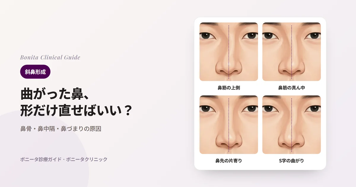 同じ人の正面の鼻のイラスト四枚と顔の中心の点線：鼻筋の上側（鼻骨）が傾いた場合、鼻筋の真ん中が曲がった場合、鼻柱と鼻先が片側に寄った場合、S字に曲がった場合。カードごとに検討する矯正方法を書いた。