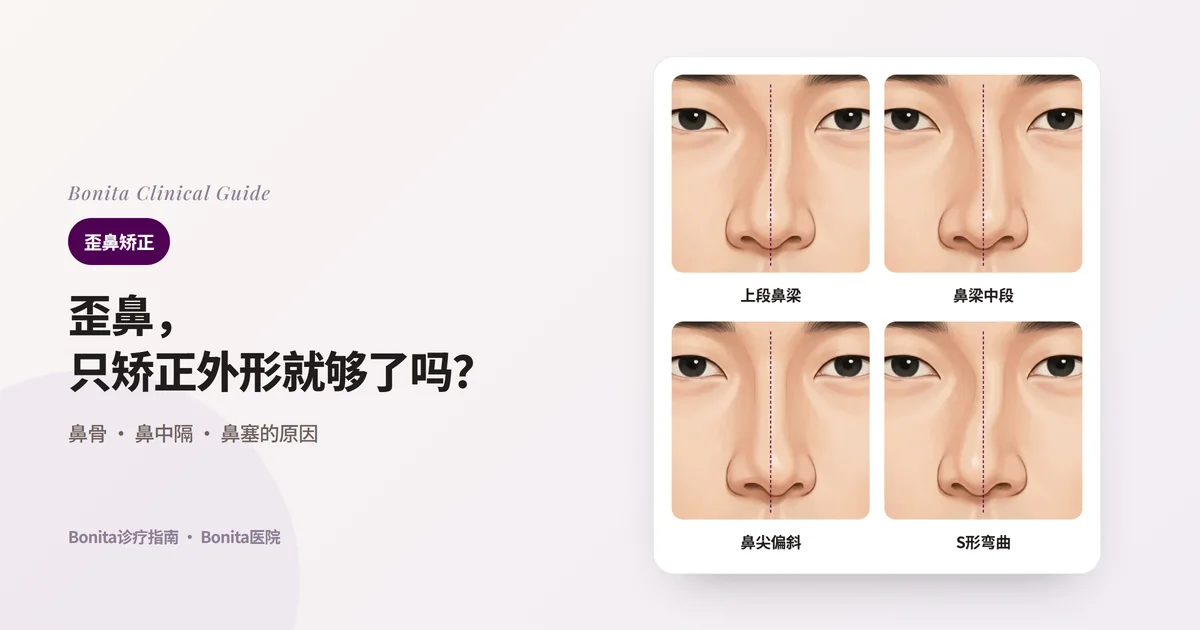 同一个人的四张正面鼻子插图和脸部中线虚线：上段鼻梁（鼻骨）倾斜、鼻梁中段弯曲、鼻小柱与鼻尖偏向一侧、S形弯曲，每张卡片写出考虑的矫正方法。