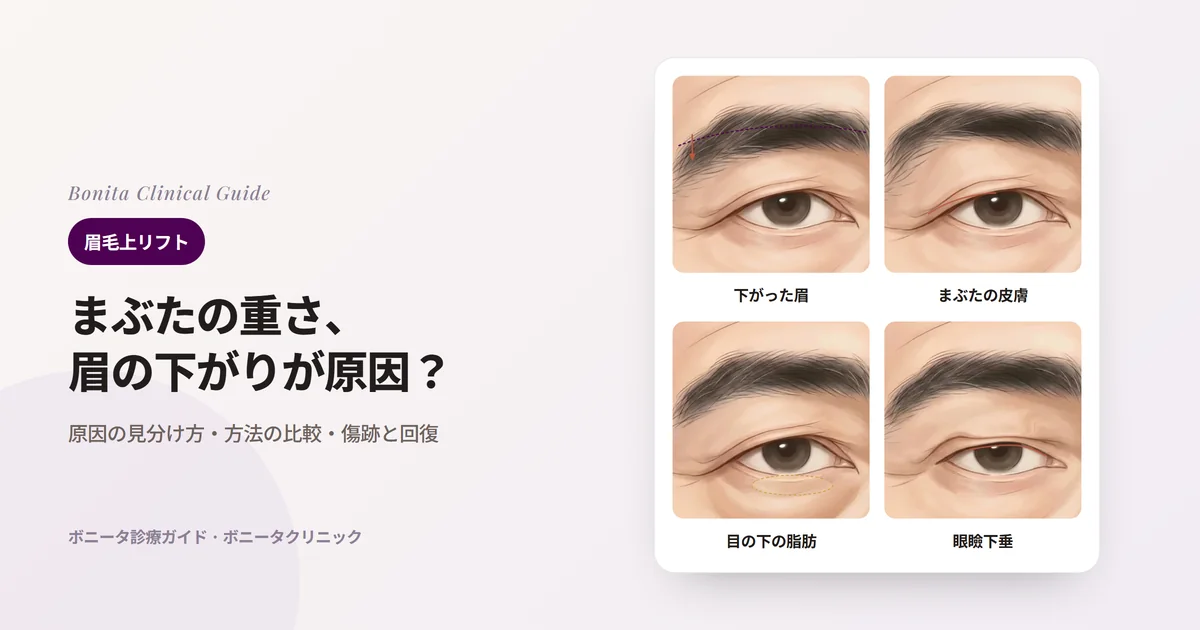 4枚の目のイラストカード：眉が下がった目、上まぶたの皮膚がたるんだ目、目の下の脂肪が出た目、まぶたの縁が黒目を覆う目と、それぞれまず検討する方法