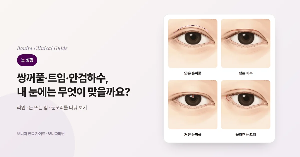 네 장의 눈 삽화 카드: 라인이 없고 눈꺼풀이 얇은 눈, 늘어진 피부가 라인을 덮은 눈, 눈꺼풀이 눈동자를 덮은 눈, 눈꼬리가 올라간 짧은 눈과 각각 먼저 검토하는 수술