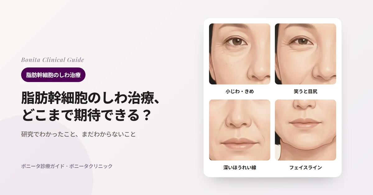 同じ40代後半女性の正面のイラスト4枚：何もしなくても見える小じわと粗いきめ、笑うと目尻にできる表情じわ、深いほうれい線、たるんだフェイスラインと、それぞれまず考える方法を記したカード