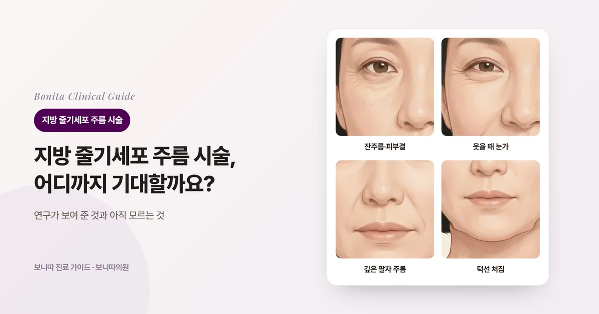 같은 40대 후반 여성의 정면 삽화 네 장: 가만히 있어도 보이는 잔주름과 거친 피부결, 웃을 때 눈꼬리에 생기는 표정 주름, 깊게 패인 팔자 주름, 처진 턱선과 각각 먼저 생각하는 방법을 적은 카드