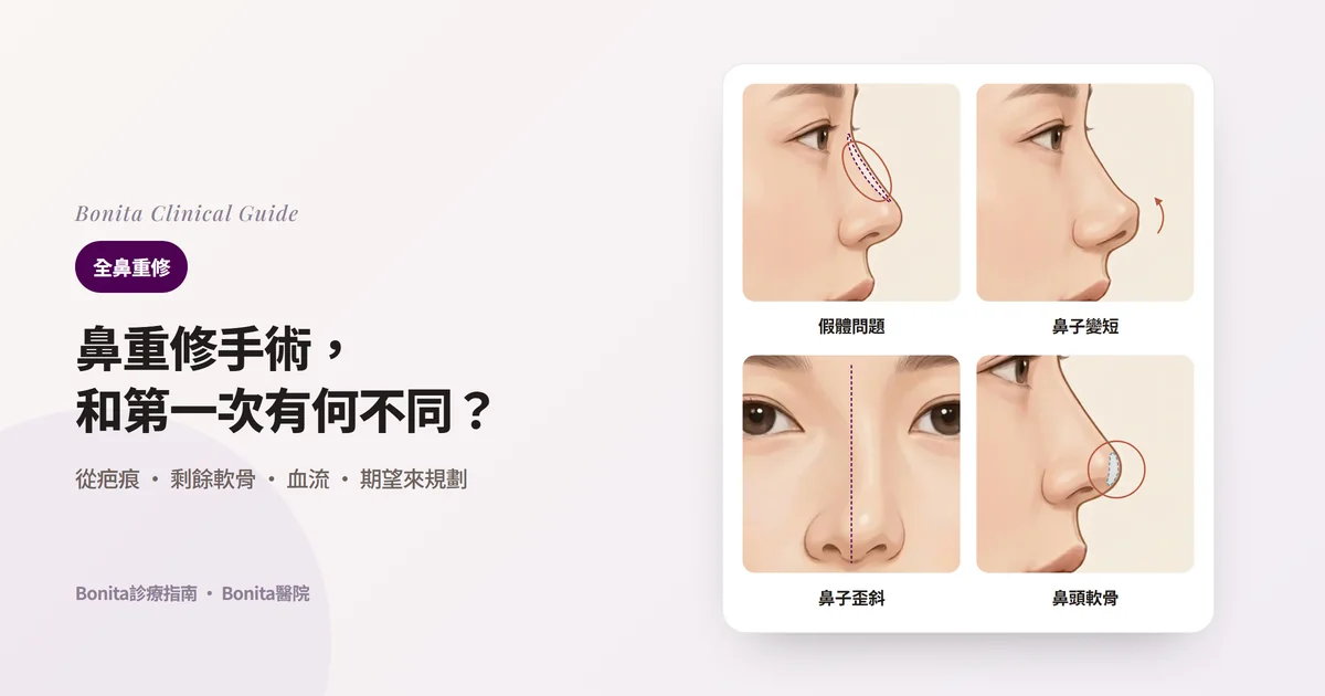 在側面與正面插圖上標出四種常見鼻重修原因的卡片：鼻樑假體問題、矽膠手術後變短的鼻子、歪斜的鼻子、鼻頭軟骨問題