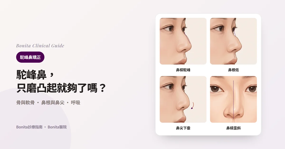 四張鼻子插圖分別標出明顯的駝峰、偏低的鼻根、下垂的鼻尖、偏向一側的鼻樑，並寫出主要考慮的方法