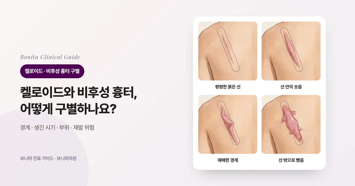 같은 사람의 왼쪽 어깨뼈 위 사선 흉터를 네 가지 모습으로 그린 카드: 평평하지만 붉은 선, 점선 안에서 도톰하게 솟은 흉터, 점선을 조금 넘은 듯 울퉁불퉁한 흉터, 점선을 넘어 집게발처럼 뻗은 흉터. 점선은 처음 상처의 경계이며, 카드마다 먼저 생각하는 것과 확인할 것을 적었다.