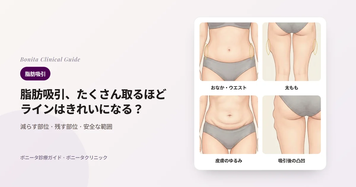 体のイラスト4枚に、わき腹が厚いウエスト、外側がふくらんだ太もも、下腹の皮膚がゆるんで折れた様子、以前の脂肪吸引後に凸凹になったお尻の横の輪郭を描き、ボニータクリニックがそれぞれ最初に確認することを書いたカード