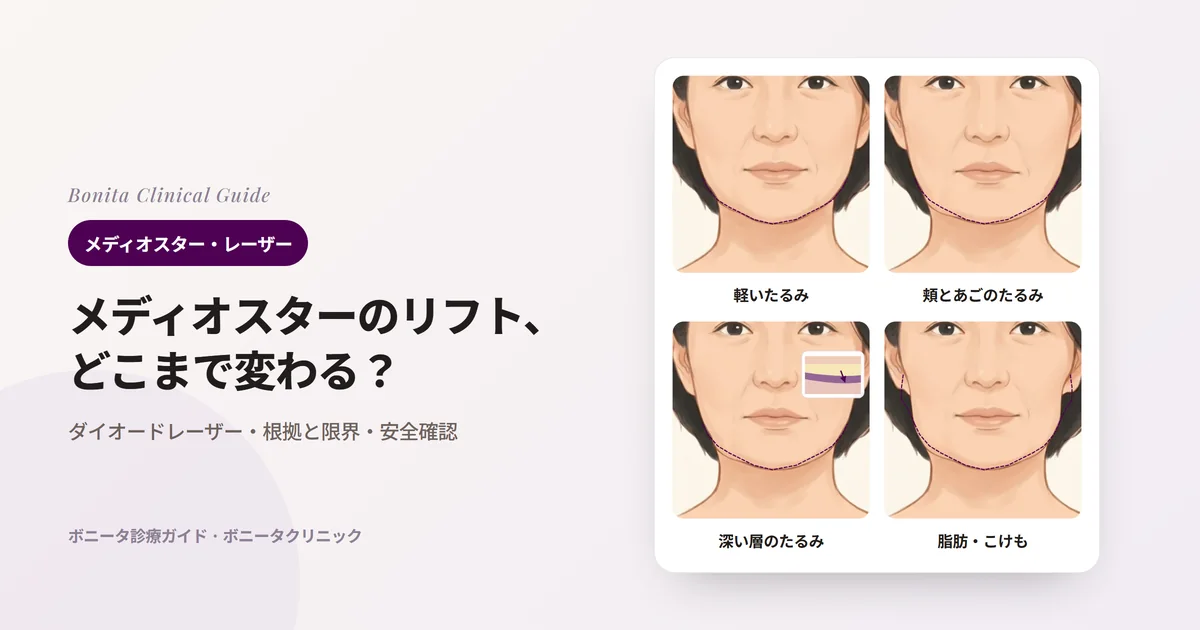 正面の顔のイラスト4枚に、元の輪郭（点線）とともに、フェイスラインが少し下がり始めた様子、頬とあごがはっきりたるんだ様子、皮膚より深い層から始まったたるみ（小さな断面）、脂肪・たるみ・こけが重なった様子を示し、まず検討する方法を書いたカード