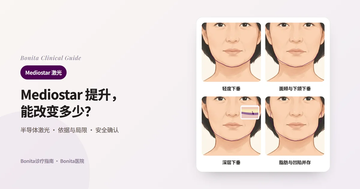 四张正面脸部插图连同原轮廓（虚线）分别显示：下颌线刚开始下垂、面颊与下颌明显下垂、从比皮肤更深的层开始的下垂（小剖面）、脂肪与下垂、凹陷并存，并写出优先考虑的方法