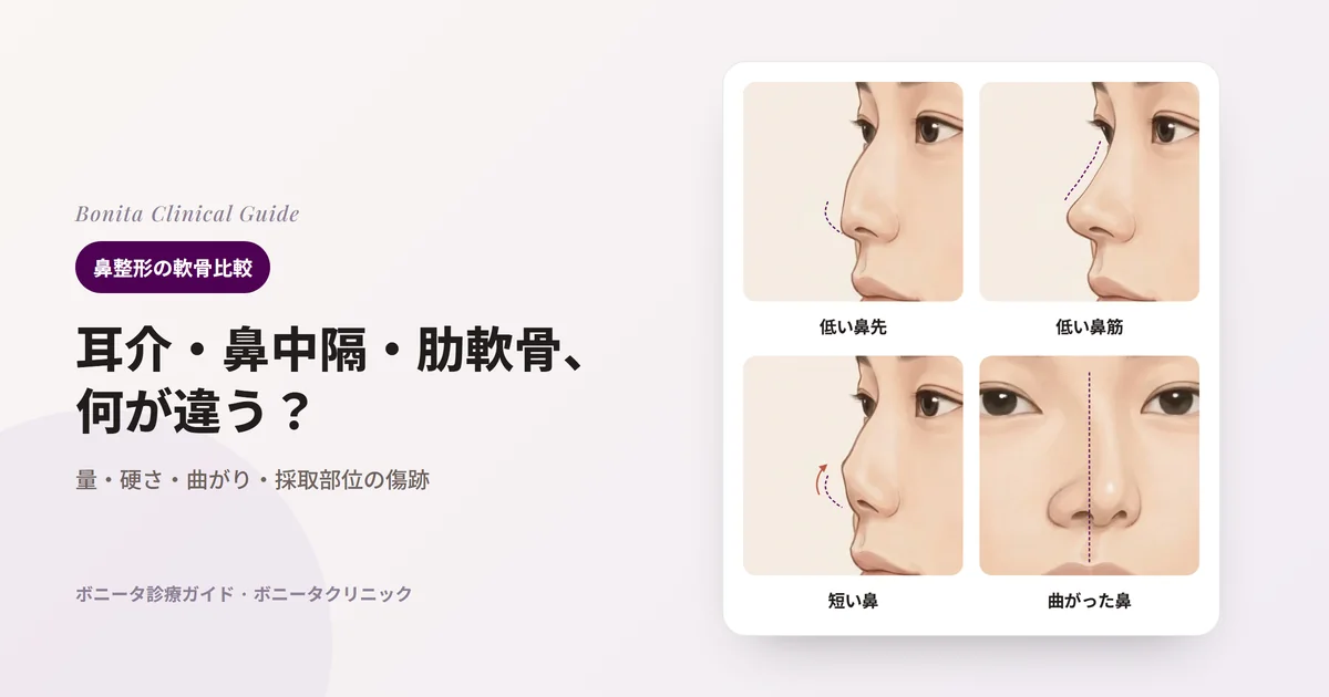 同じ人の鼻のイラスト4枚：横から見た低い鼻先、横から見た低い鼻筋、横から見た短く上を向いた鼻、正面から見た曲がった鼻。カードごとに、その状態でまず検討する軟骨を書いた。