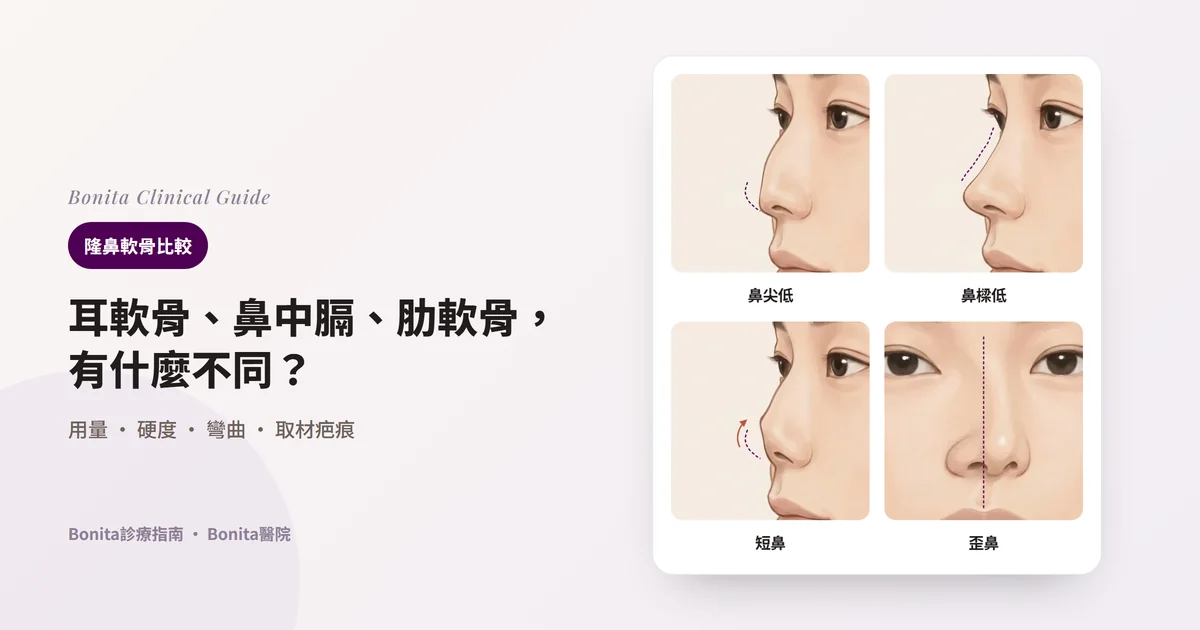 同一個人的四張鼻部插圖：側面看鼻尖低、側面看鼻樑低、側面看鼻子短而上翹、正面看鼻子歪。每張卡片寫出該狀態下優先考慮的軟骨。