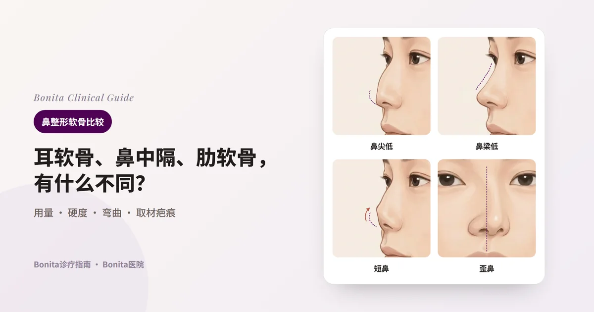 同一个人的四张鼻部插图：侧面看鼻尖低、侧面看鼻梁低、侧面看鼻子短而上翘、正面看鼻子歪。每张卡片写出该状态下优先考虑的软骨。
