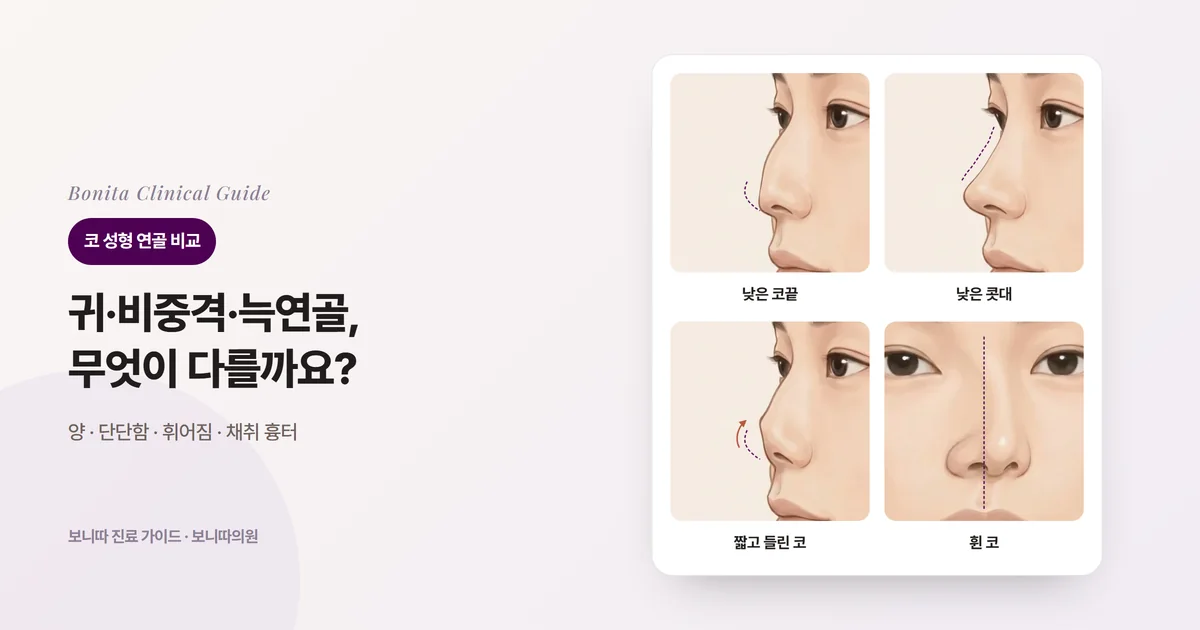 같은 사람의 코 삽화 네 장: 옆에서 본 낮은 코끝, 옆에서 본 낮은 콧대, 옆에서 본 짧고 들린 코, 정면에서 본 휜 코. 카드마다 그 상태에서 먼저 검토하는 연골을 적었다.