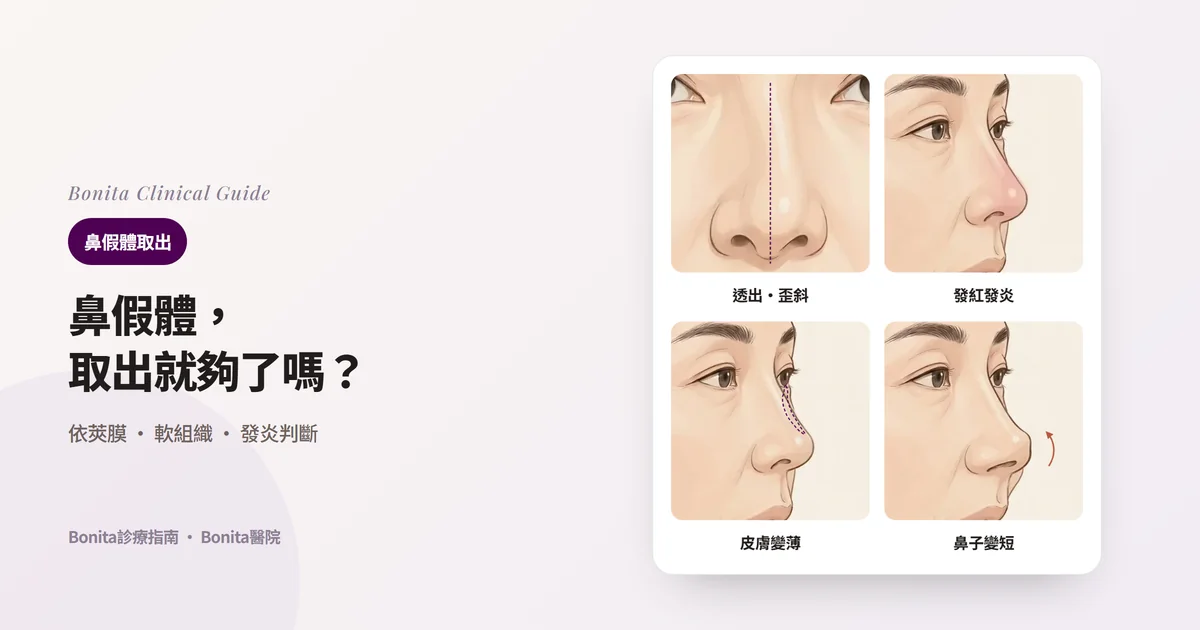 在側臉插圖上標出想取出鼻假體的四種原因的卡片：透出或歪斜的假體、反覆發紅發炎、變薄或被撐開的皮膚、變短上翹的鼻子