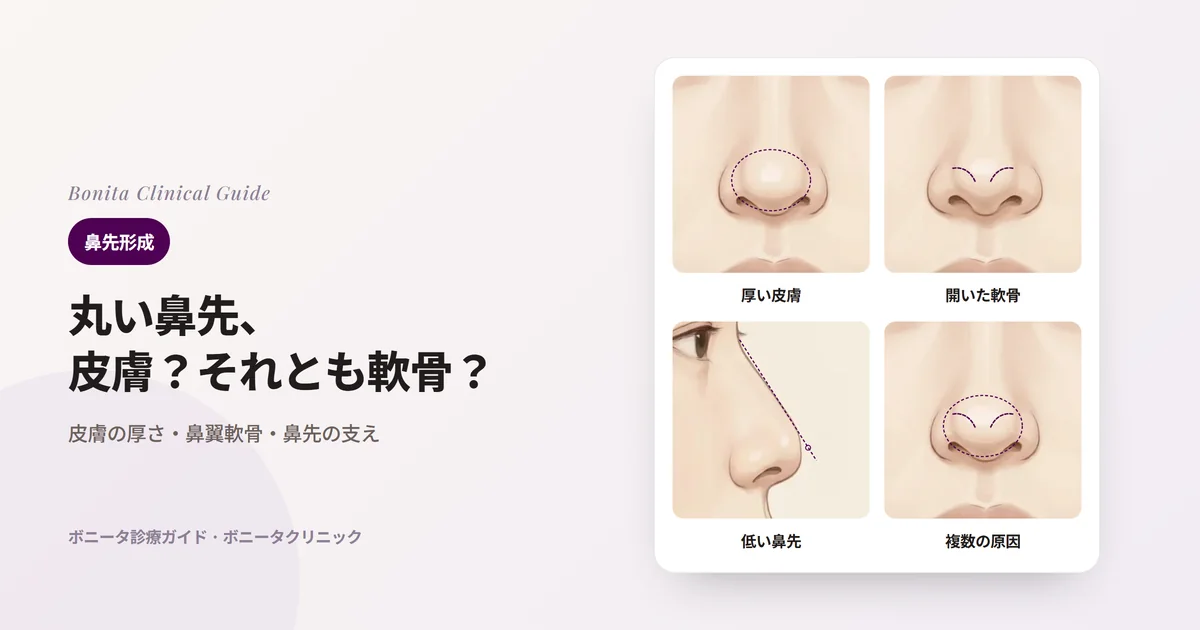 同じ人の鼻先のイラスト四枚：皮膚と軟部組織が厚く丸い鼻先（点線は覆う組織）、鼻翼軟骨が開いて広い鼻先（点線は軟骨の位置）、低く弱い鼻先の横顔（点線は鼻根と鼻先を結ぶ線）、いくつもの原因が重なった鼻先。カードごとに主に検討する方法を書いた。