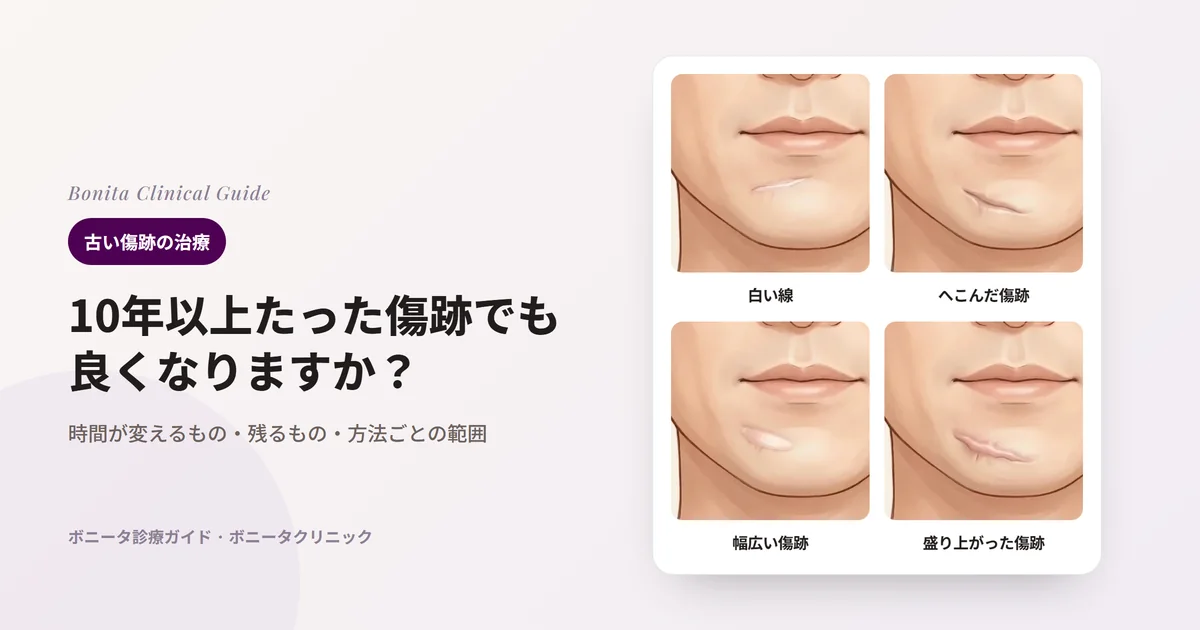 同じ男性のあご先、下唇の下に残った古い傷跡を4つの状態で描いたカード：白く平らな線、下にへこんで影ができた傷跡、幅広く広がった帯状の傷跡、盛り上がった傷跡。カードごとに主に検討する方法を記した。