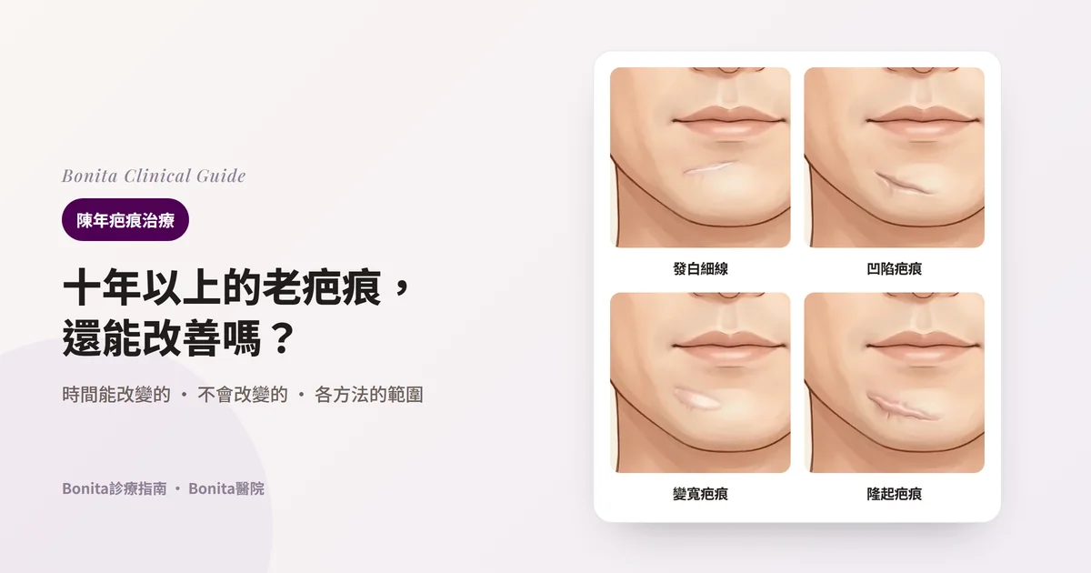 四張卡片畫出同一位男性下巴前方、下唇下面的陳年疤痕：發白的平坦細線、向下凹陷有陰影的疤痕、變寬的帶狀疤痕、隆起的疤痕。每張卡片寫出主要考慮的方法。