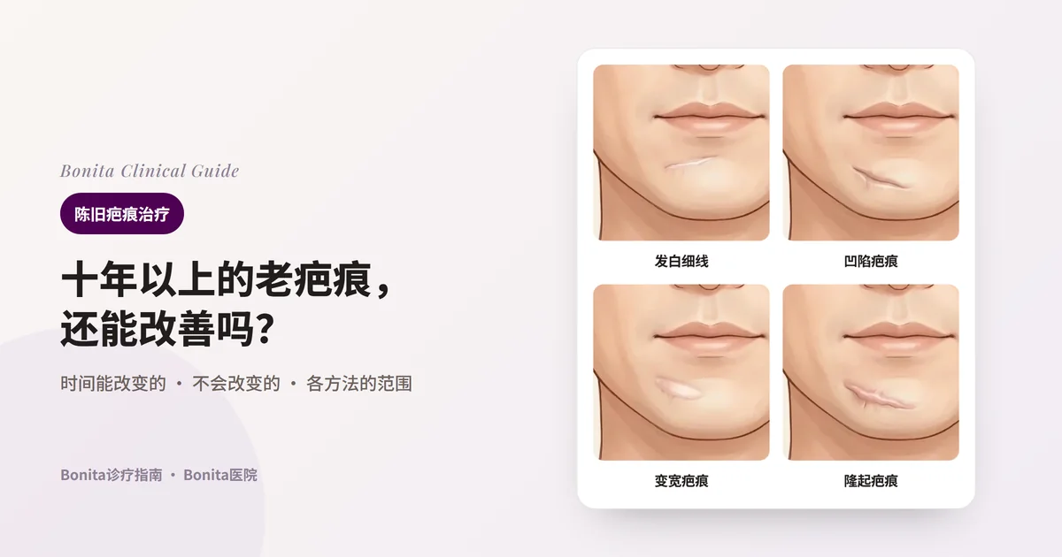 四张卡片画出同一位男性下巴前方、下唇下面的陈旧疤痕：发白的平坦细线、向下凹陷有阴影的疤痕、变宽的带状疤痕、隆起的疤痕。每张卡片写明主要考虑的方法。