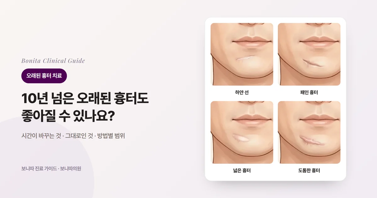 같은 남성의 턱 앞, 아랫입술 아래에 남은 오래된 흉터를 네 가지 모습으로 그린 카드: 하얗고 납작한 선, 아래로 패여 그늘이 진 흉터, 넓게 벌어진 띠 모양 흉터, 도톰하게 솟은 흉터. 카드마다 주로 검토하는 방법을 적었다.
