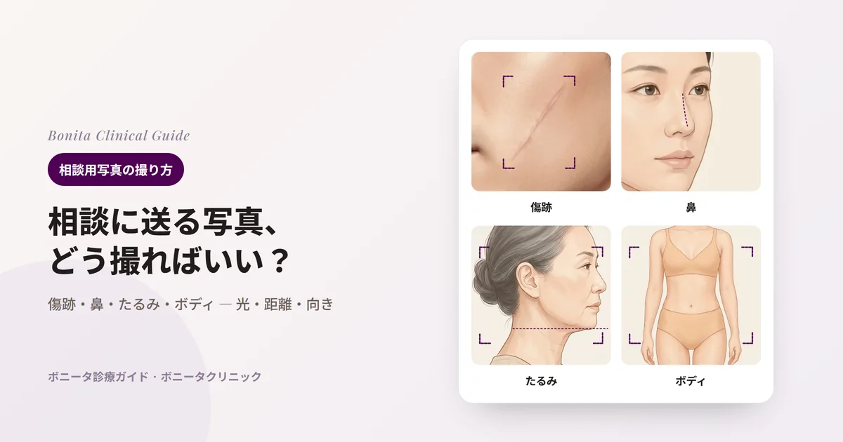 新しく描いたイラスト4枚:細い傷跡のある男性の頬のアップと、接写する範囲を四隅の枠で示した図、45度から見た女性の鼻と鼻筋のライン、髪をまとめた中年女性の横顔を四隅の枠に収め、あご先の高さに引いた水平の点線、顔が写らないよう首から下、太ももの上までを入れた体の正面。カードごとに、その部位で加えたい写真を書いた。