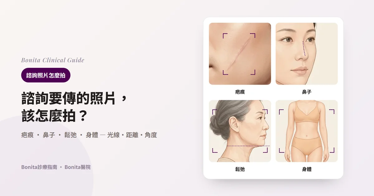 新繪製的四張插圖:男性臉頰上一道細疤痕的特寫,用四角框標出特寫範圍;45度看到的女性鼻子與鼻樑線;綁起頭髮的中年女性側面放在四角框裡,下巴尖高度畫了一條水平虛線;不拍進臉部、從脖子以下到大腿上部的身體正面。每張卡片寫出該部位建議補拍的照片。