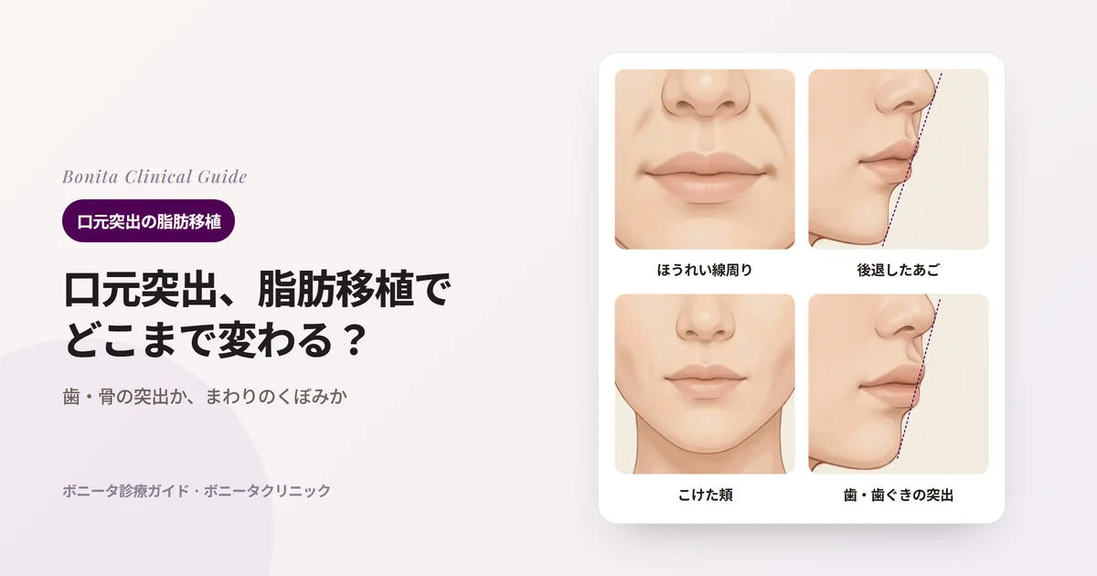 同じ20代女性のイラスト4枚：正面でほうれい線まわりがくぼんだ場合、横顔であご先が後ろに引っ込んだ場合、正面で頬がくぼんだ場合、横顔で唇が歯と一緒に前に出た場合と、それぞれまず確かめる内容を記したカード。横顔には鼻先とあご先を結ぶ線を点線で示した。