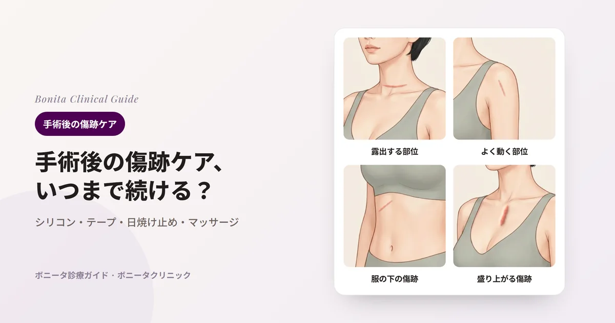 同じ人の体のイラスト4枚：首の下のしわにある細い赤い傷跡、肩の前の細い傷跡、肋骨の下の上腹部の傷跡、胸の中央に赤く厚く盛り上がった傷跡。カードごとに、自宅でまず考えるケアを記した。