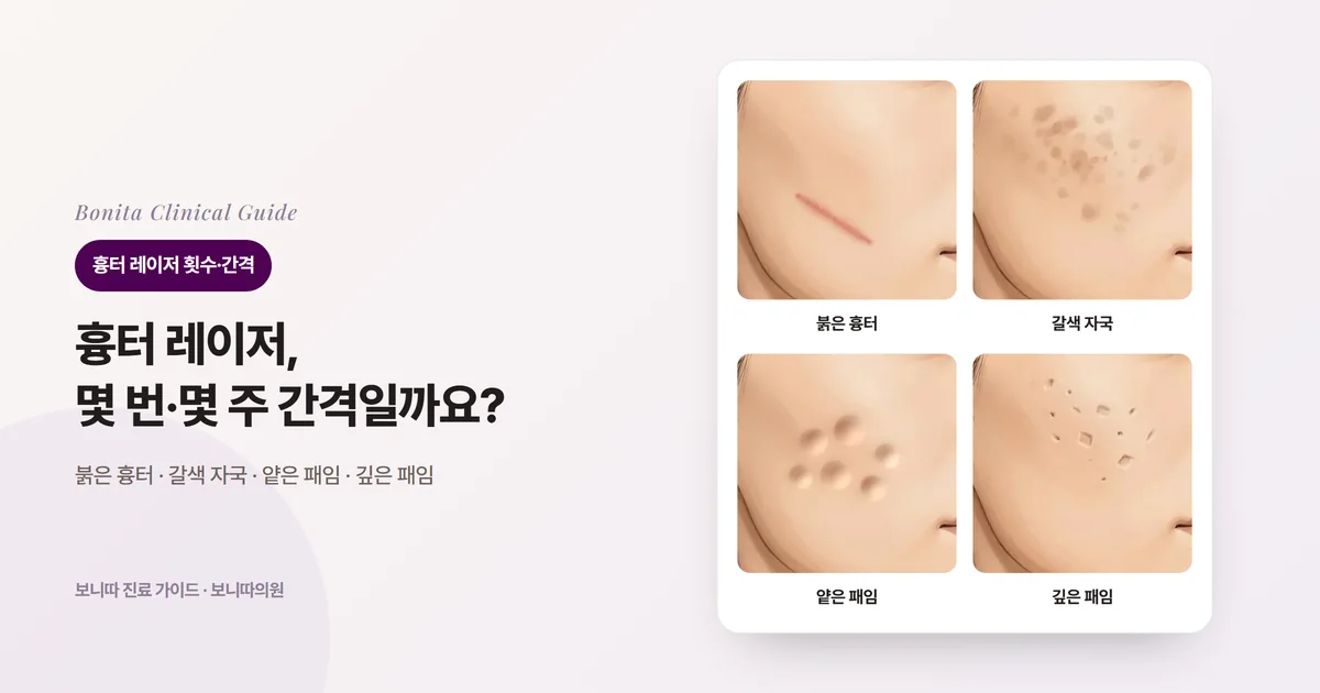 같은 사람의 뺨을 그린 삽화 네 장: 붉은 선 모양 흉터, 갈색 자국, 얕고 넓은 패임, 좁고 깊은 패임. 카드마다 주로 검토하는 레이저나 방법을 적었다.