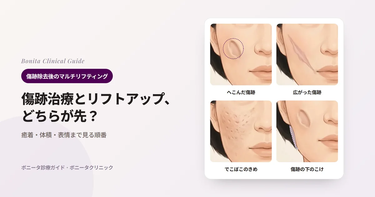 同じ顔の同じほお4枚に、へこんだ傷跡、幅の広がった傷跡、でこぼこのきめと跡、傷跡の下でこけたほおの輪郭を描き、それぞれまず行うことを記したカード