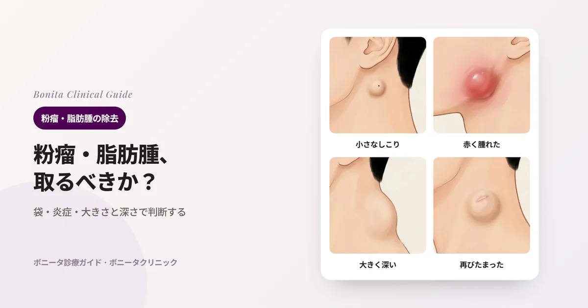 首の横のイラスト4枚に、耳たぶの下の炎症のない小さなしこり、あごの前の赤く腫れて痛むしこり、うなじの大きく深いしこり、押し出した跡のある再びたまったしこりをそれぞれ描き、最初にすることを書いたカード