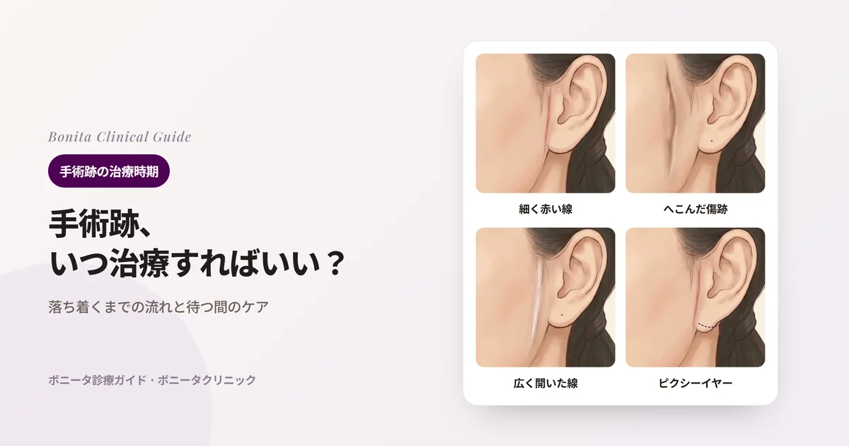 同じ人の横顔のイラスト4枚の耳の前に、細く赤い線の傷跡、へこんで引っぱられた傷跡、広く開いた傷跡、耳たぶが前下に引かれたピクシーイヤーを描き、ボニータクリニックの方法を書いたカード