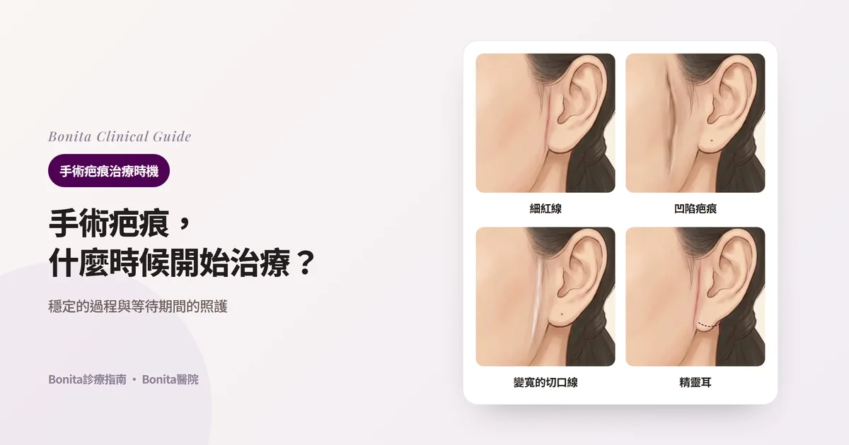 同一個人的側臉插畫四張，在耳前分別畫出細紅線疤痕、凹陷被牽拉的疤痕、明顯變寬的疤痕，以及耳垂被往前下方拉的精靈耳，並寫出Bonita醫院所用方法的卡片