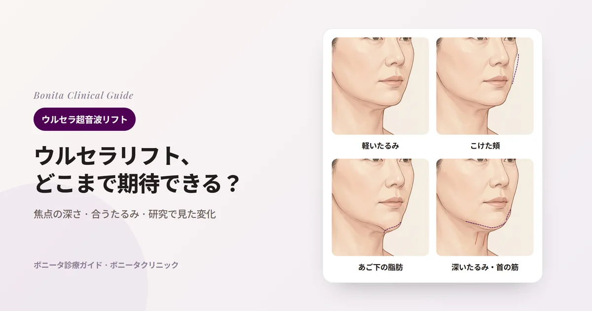 斜めから見た顔のイラスト4枚に、軽くゆるんだフェイスライン、元の輪郭（点線）よりこけた頬、あご下にたまった脂肪、深くたるんだフェイスラインと首の筋を示し、それぞれ検討する方法を書いたカード