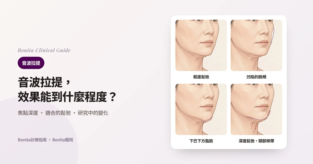 四張斜側臉插圖分別顯示輕度鬆弛的下顎線、比原輪廓（虛線）凹陷的臉頰、堆積在下巴下方的脂肪、深度下垂的下顎線與頸部條帶，並寫出各自考慮的方法