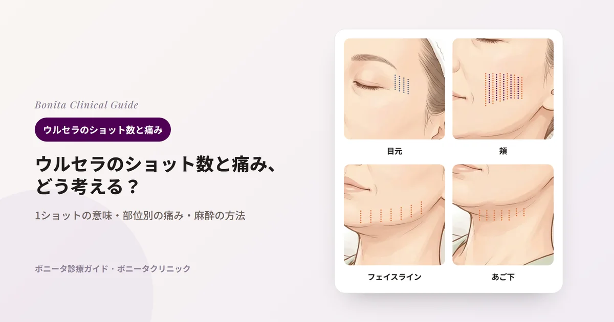 同じ女性のイラストから目元、頬、フェイスライン、あご下を切り出した4枚のカード。カードごとにその部位にショットの列を点線で描き、列の分け方と痛みについて記した。