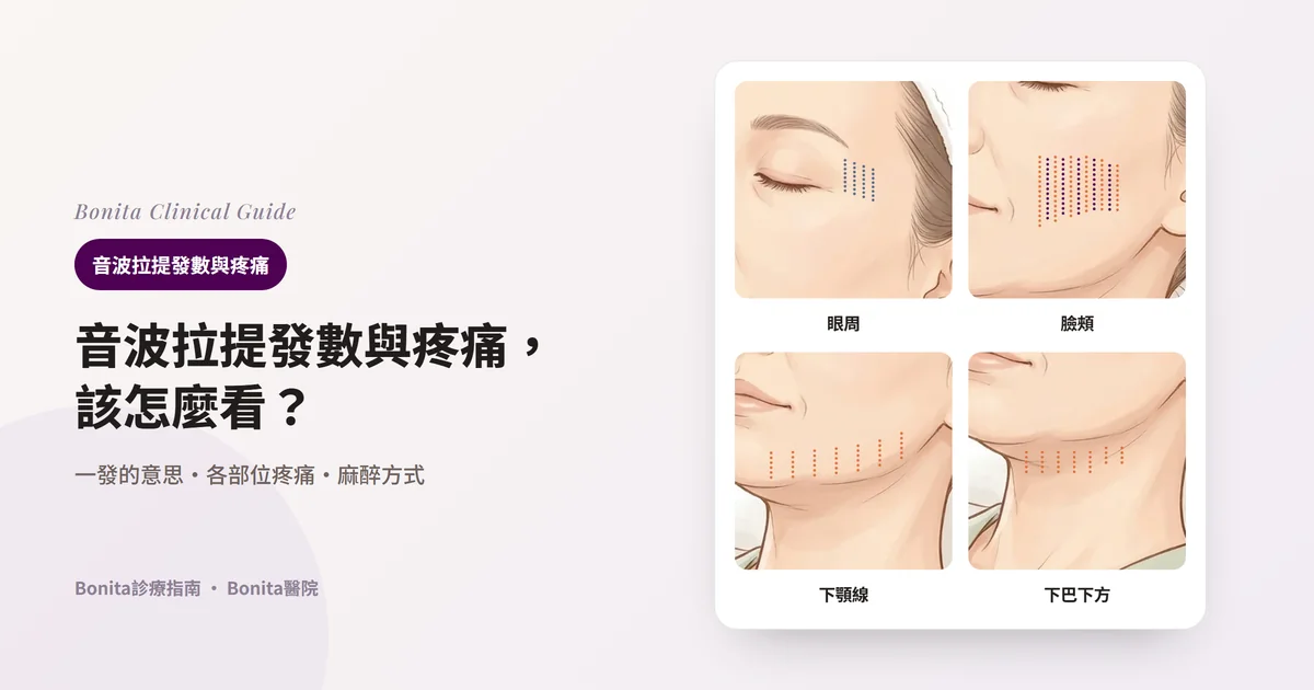 從同一張女性插圖裁出的四張卡片：眼周、臉頰、下顎線、下巴下方。每張卡片在該部位用虛線畫出一行行的發數，並寫明分配方式和疼痛情況。