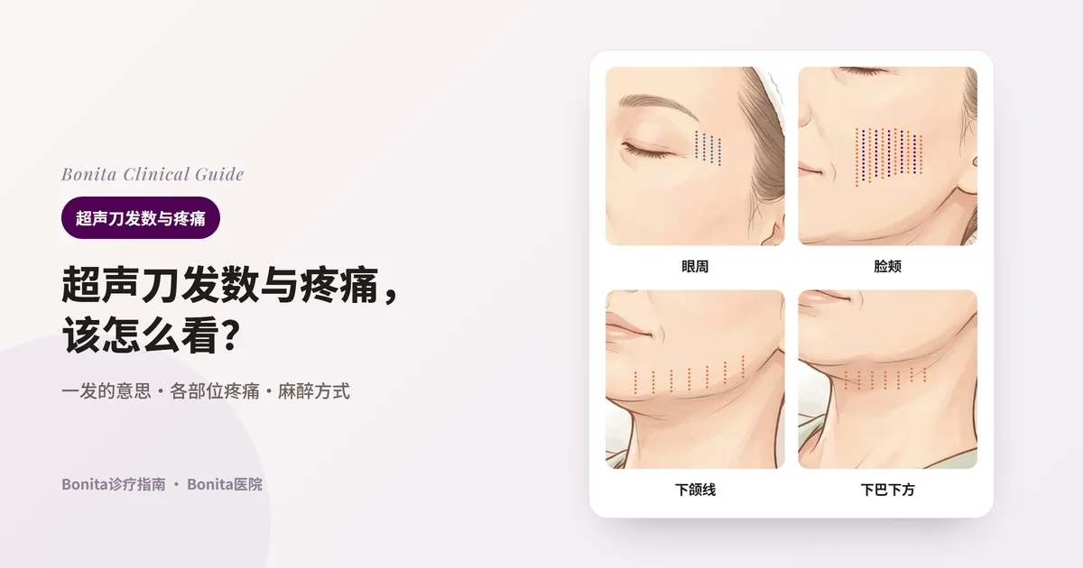 从同一张女性插图裁出的四张卡片：眼周、脸颊、下颌线、下巴下方。每张卡片在该部位用虚线画出一行行的发数，并写明分配方式和疼痛情况。