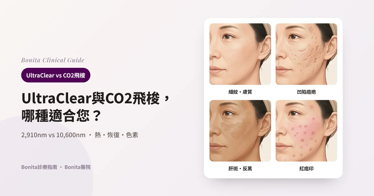 同一位女性的四分之三側臉插圖四張：眼角細紋與粗糙膚質、臉頰深而寬的痘疤、顴骨上的肝斑與較深膚色、臉頰的紅痘印，各自寫出先考慮的雷射