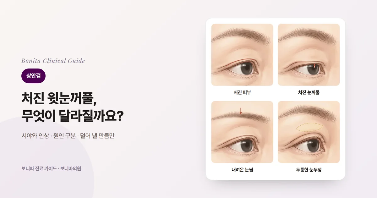 네 장의 눈 삽화 카드: 피부가 속눈썹 선을 덮은 눈, 눈꺼풀 테두리가 검은자를 가린 눈, 눈썹이 내려온 눈, 눈두덩이 두툼한 눈과 각각 먼저 검토하는 방법