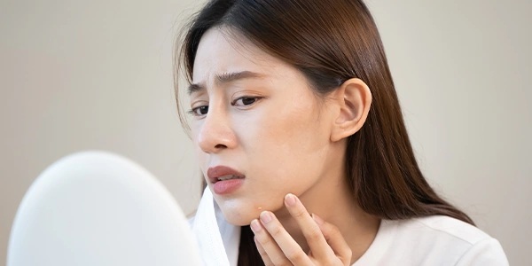 피지낭종·지방종 제거